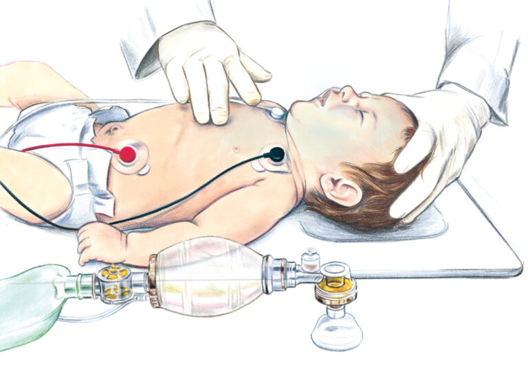 Evolution of Pediatric Resuscitation Protocols