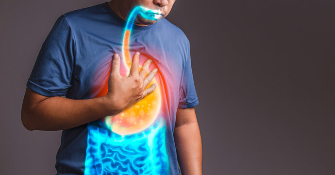 How is GERD Treated?